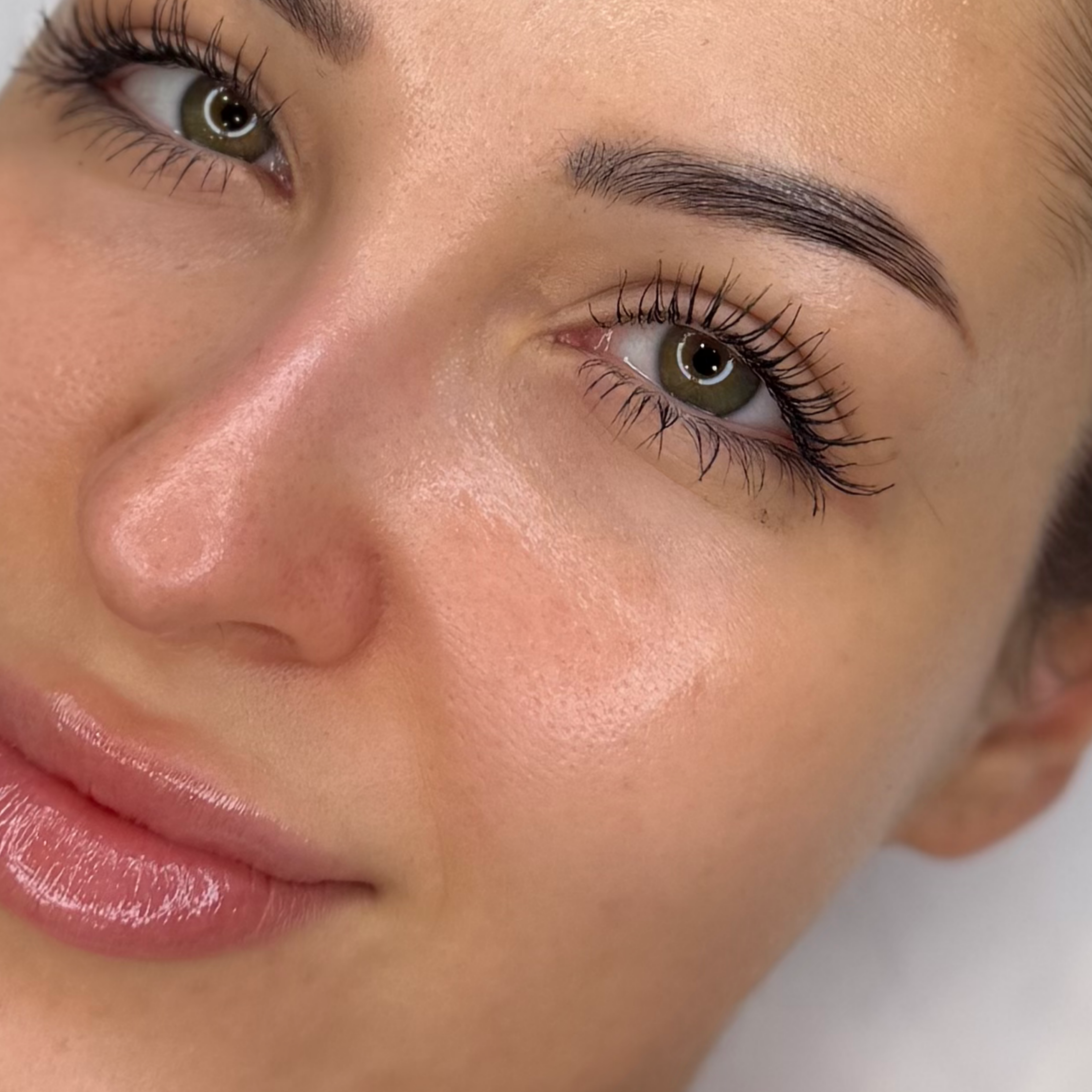 Hydrabeauty és hyaluronsavas kombinált kezelés