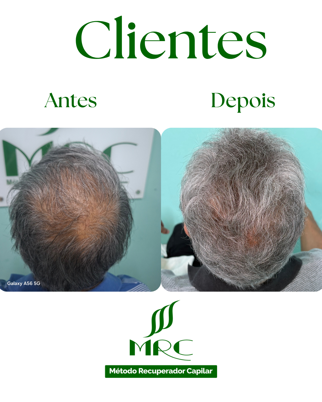 Cliente — Antes e Depois 1