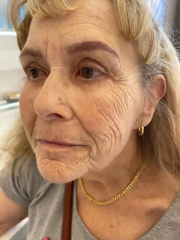 Documented Facial Views view 02