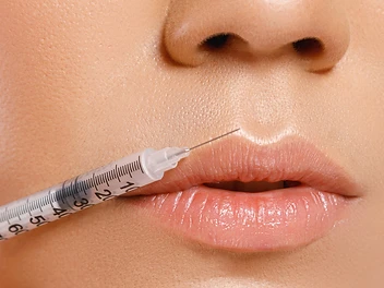 Dermal Fillers