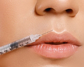 Dermal Fillers