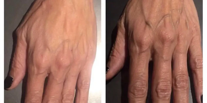 Hand Texture Progress after