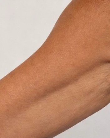 Upper-Arm Firmness Reference after