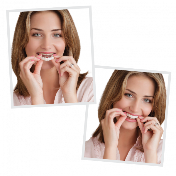 Woman applying her Snap-On Smile dental appliance