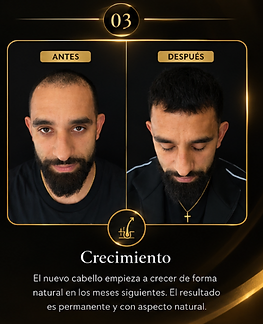 Comparación antes y después del crecimiento capilar