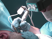 Implantación