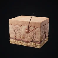 Ilustración de un folículo miniaturizado que produce un cabello más fino y corto