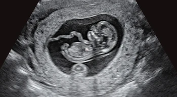 A developing embryo seen through medical imaging.