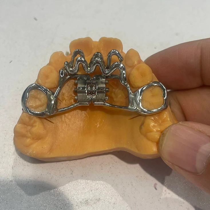 Orthodontic dental restoration
