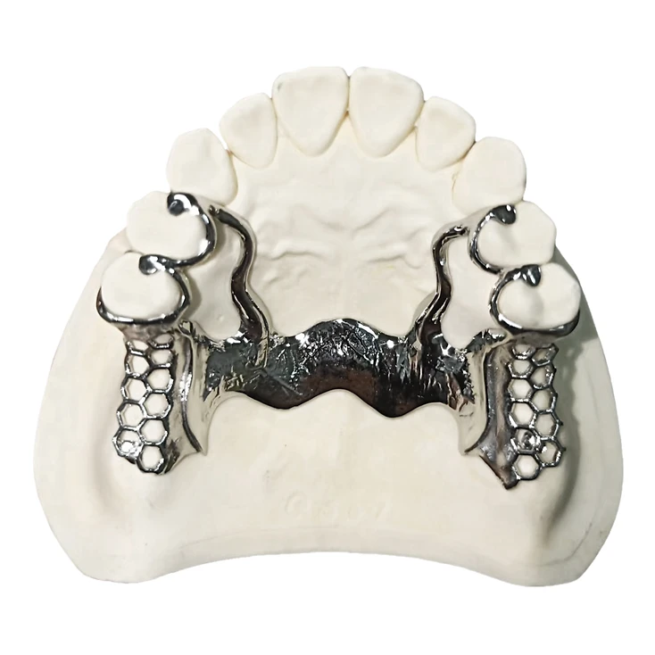 Removable Restoration dental restoration