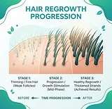 Keeps hair growth treatment