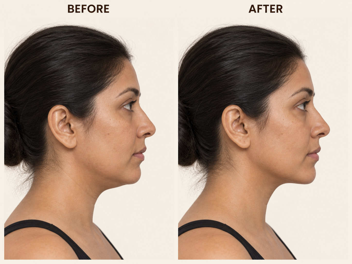 Jawline before-and-after comparison 9