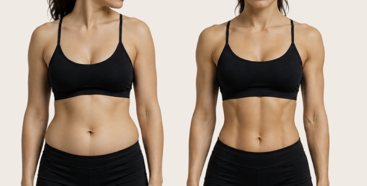 Before and after muscle stimulation treatment