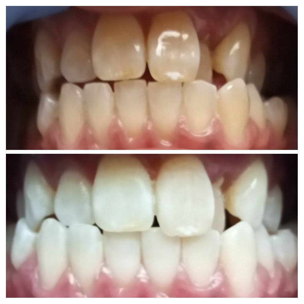 Before & After