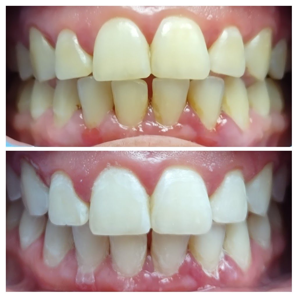 Before & After