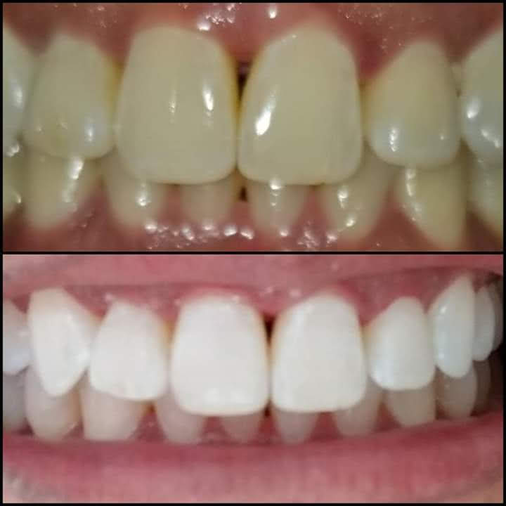 Before & After