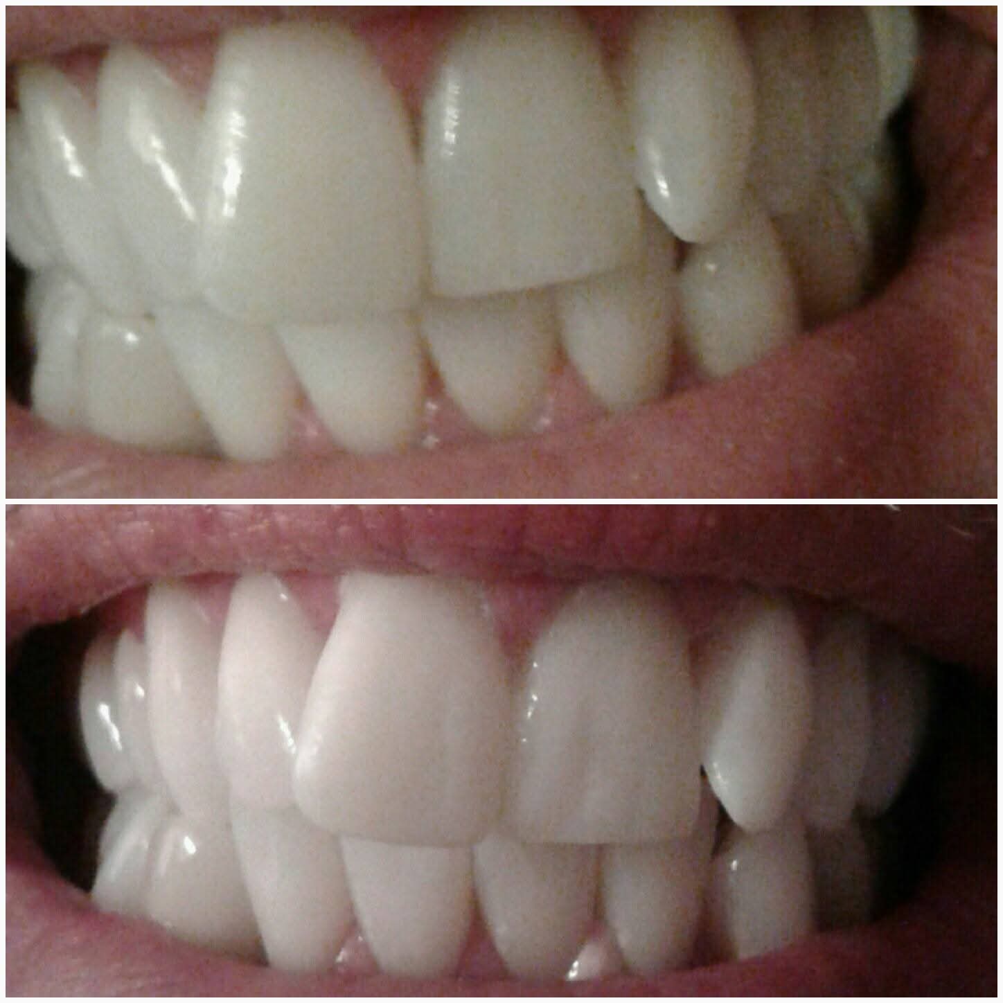 Before & After