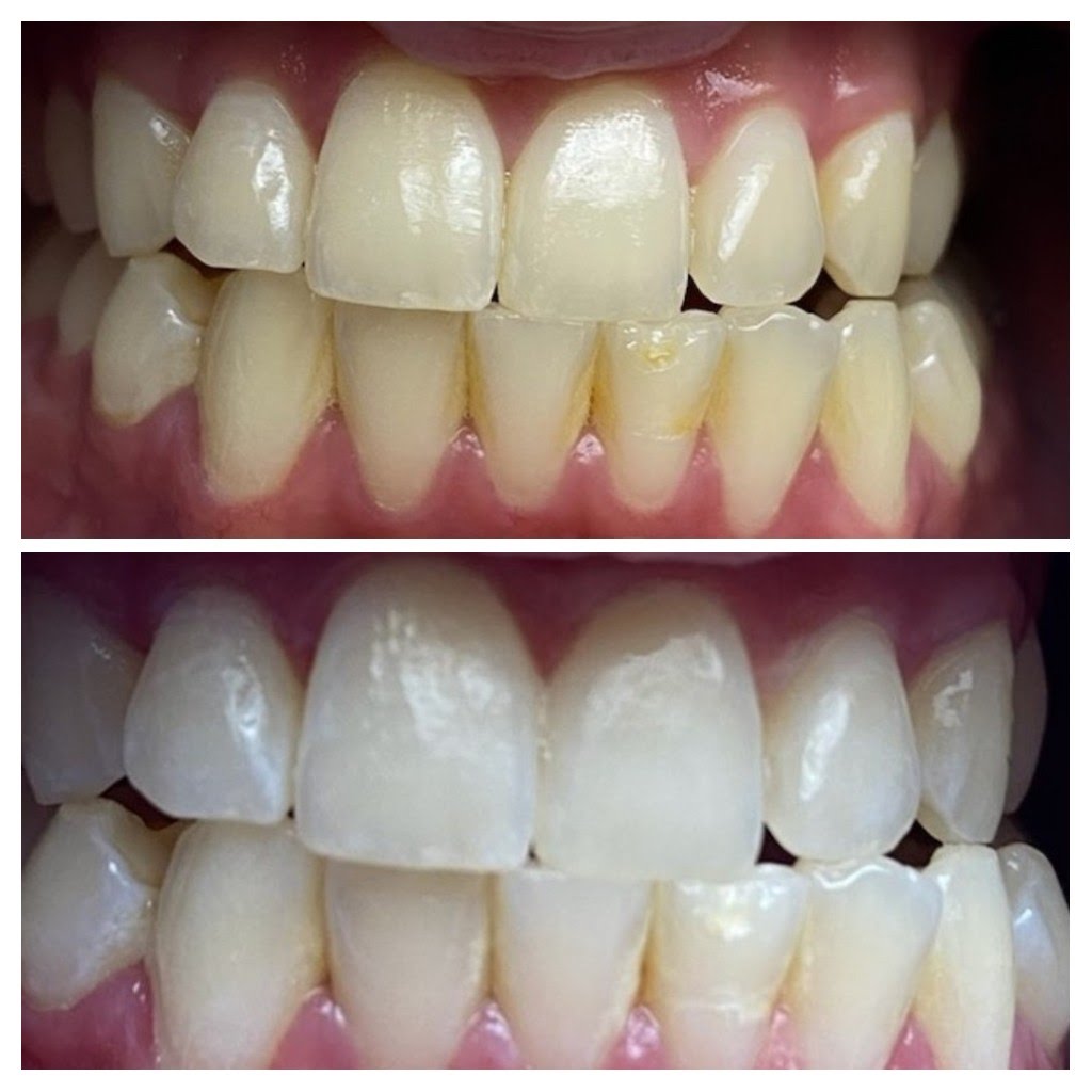 Before & After