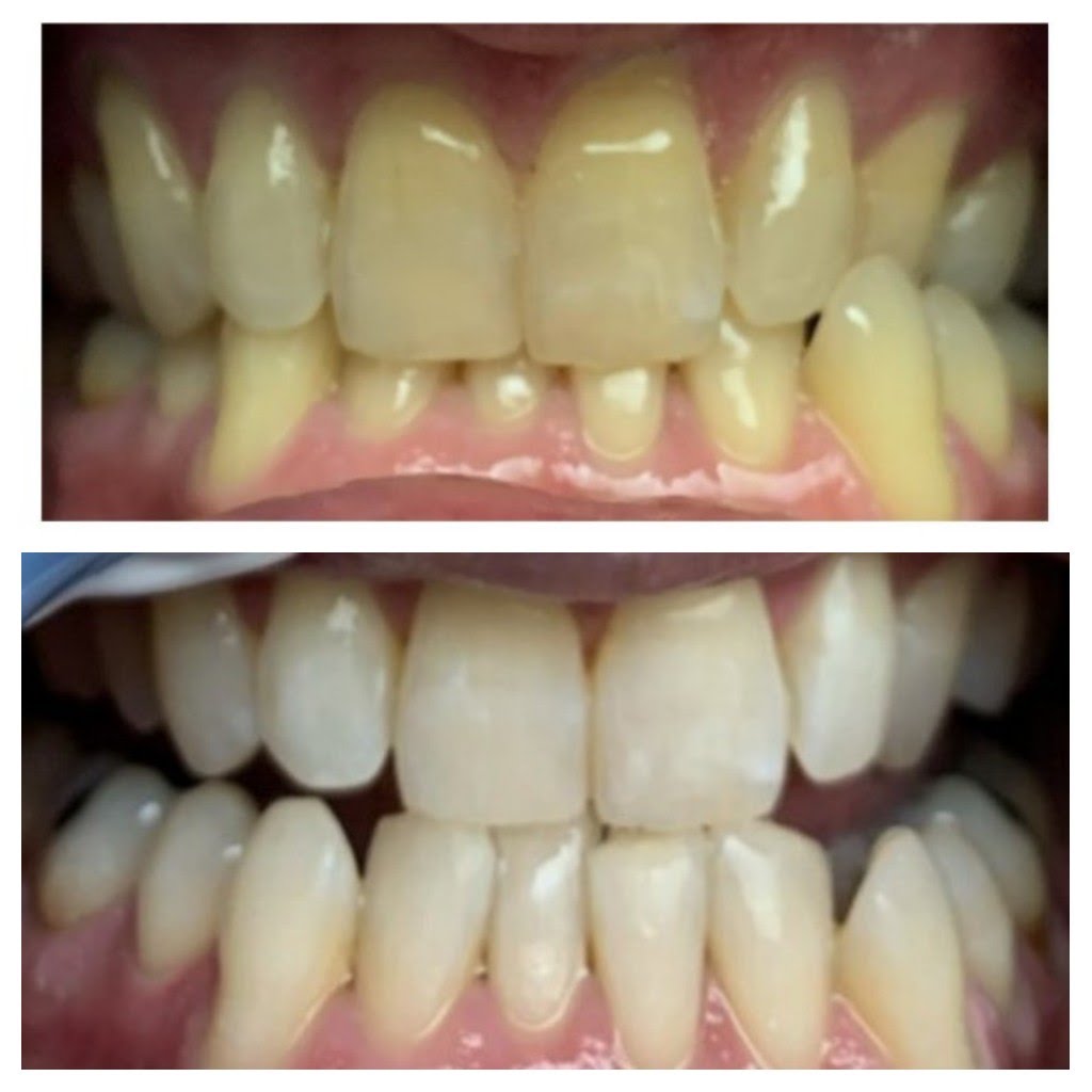Before & After
