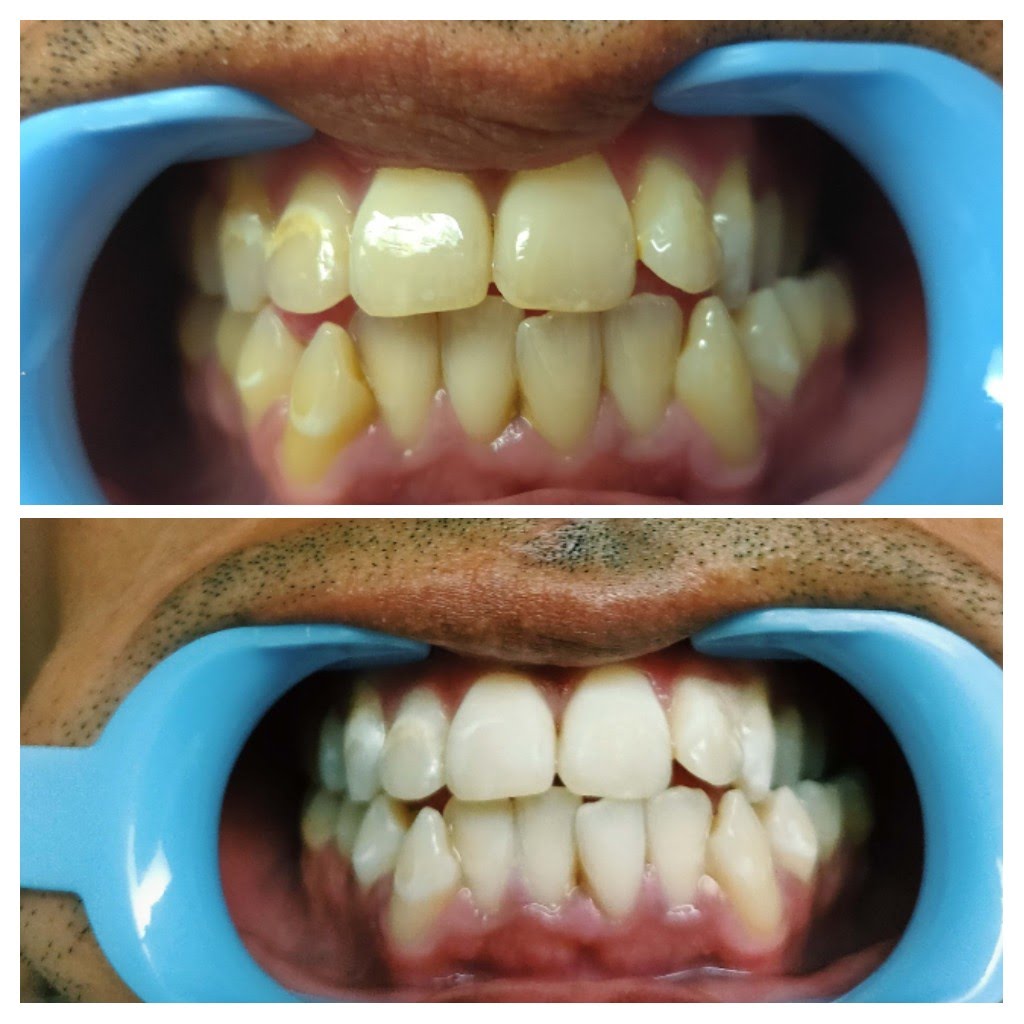 Before & After