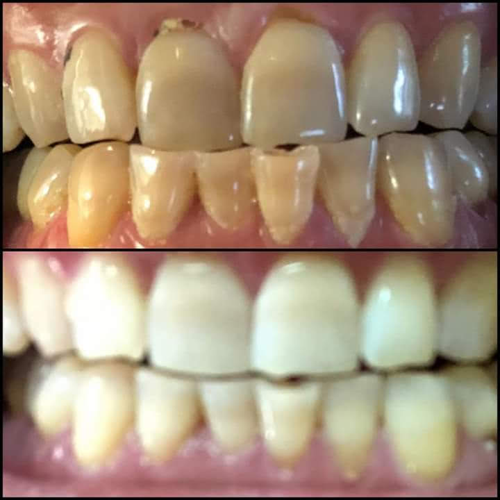 Before & After