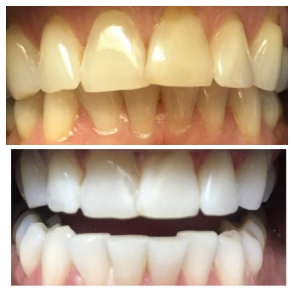 Before & After