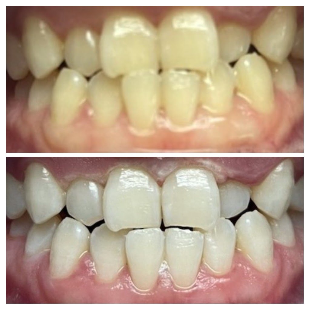 Before & After