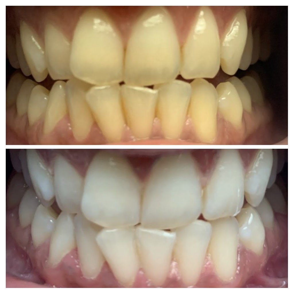 Before & After