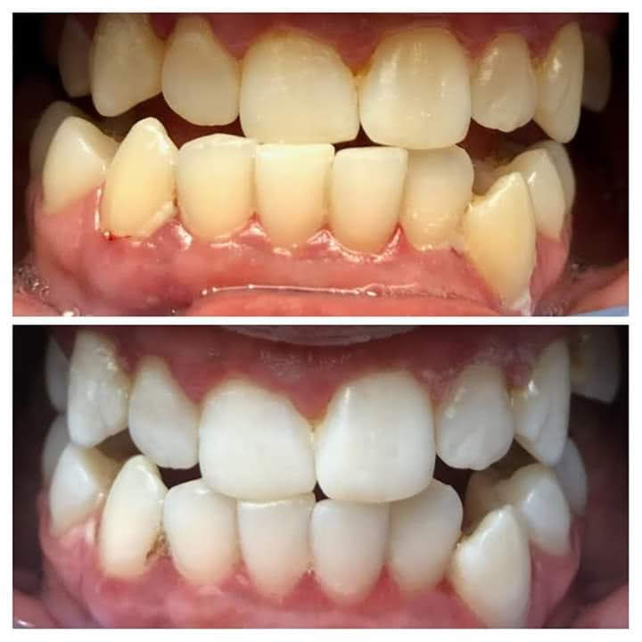 Before & After