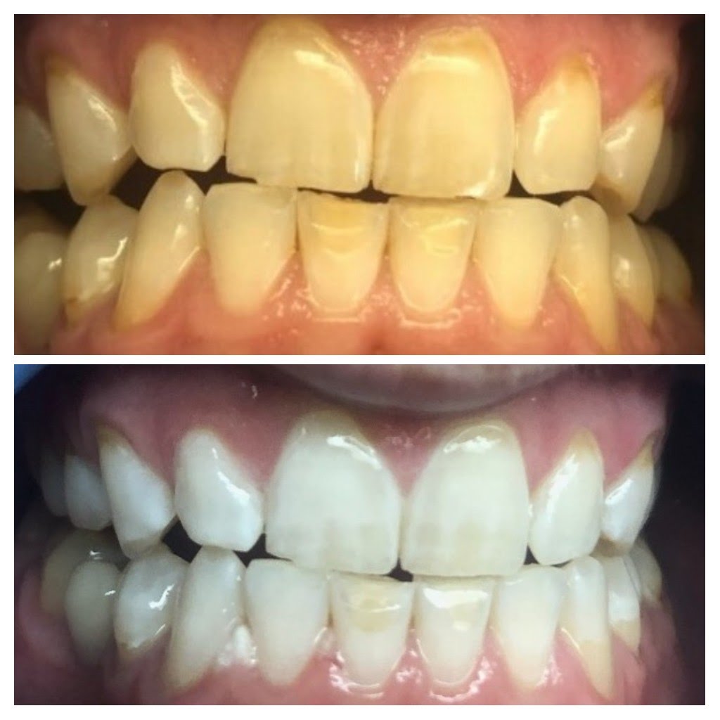 Before & After