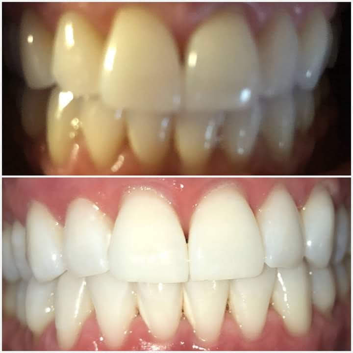 Before & After