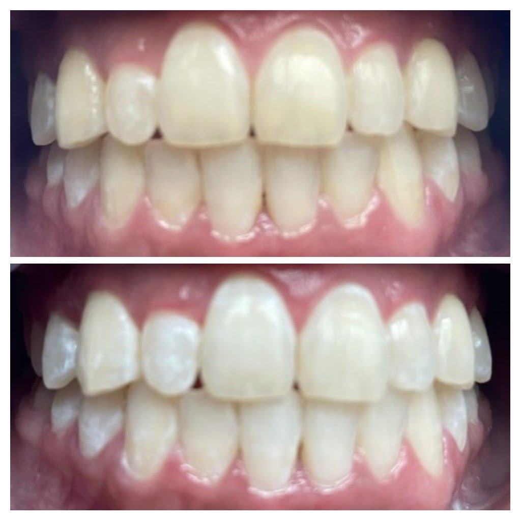 Before & After