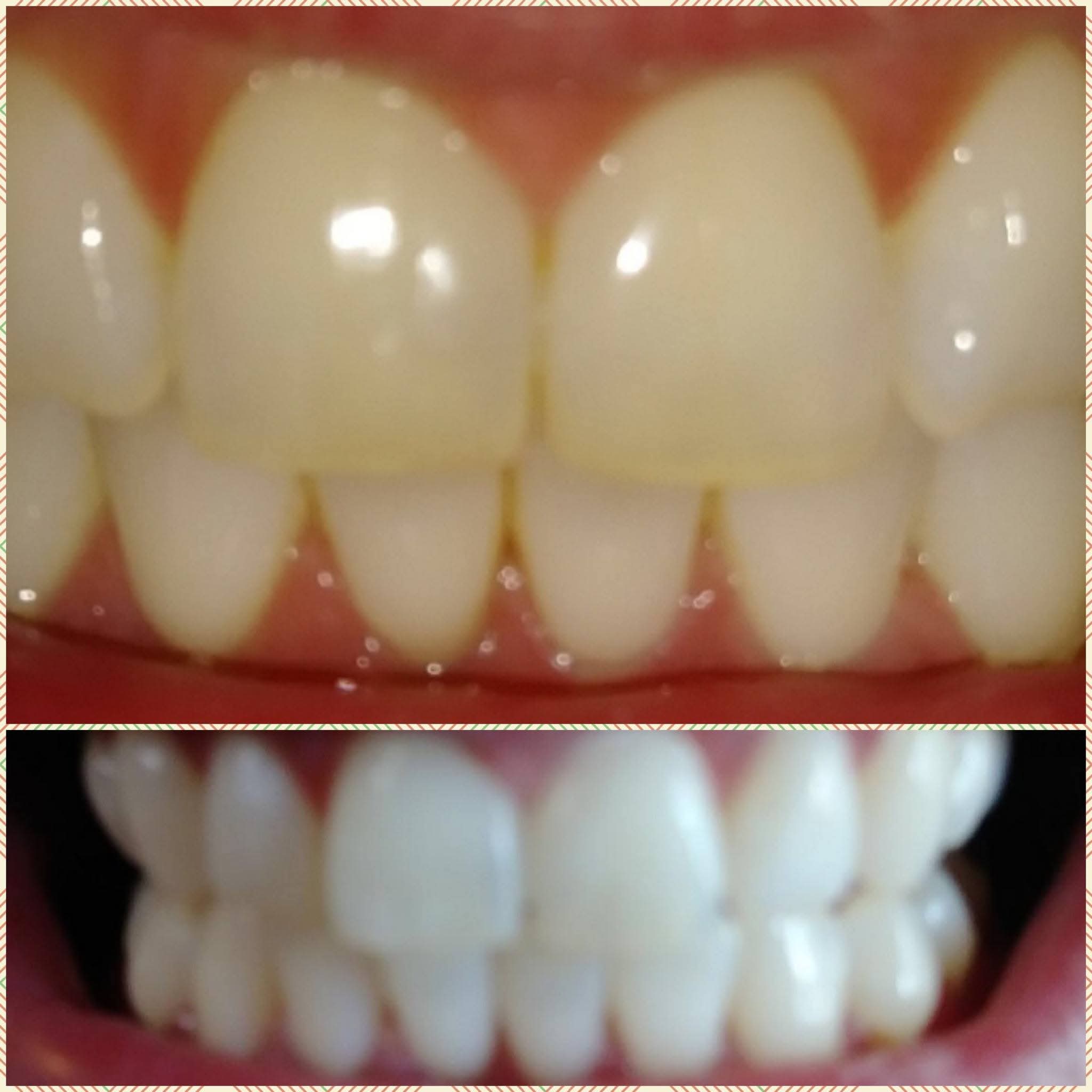Before & After
