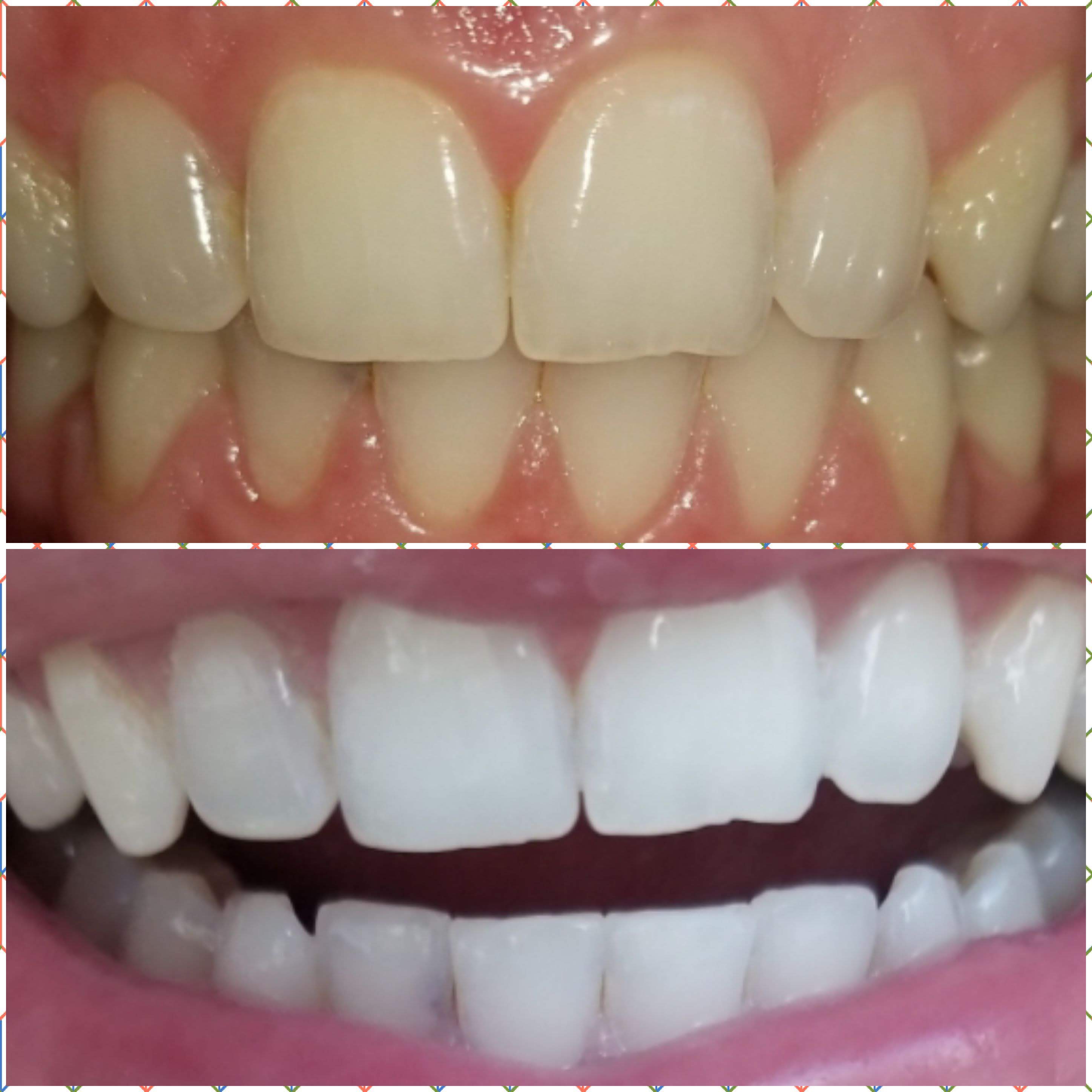 Before & After