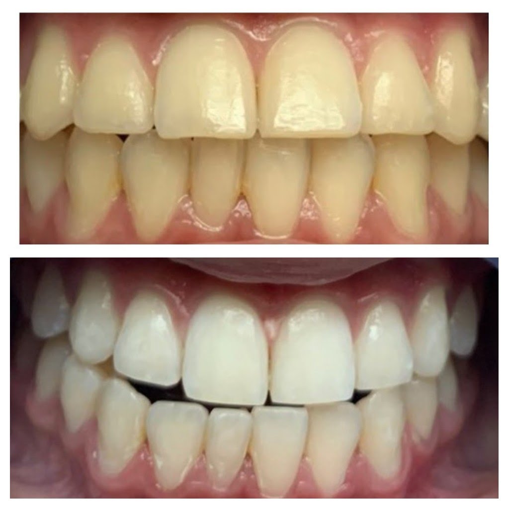 Before & After