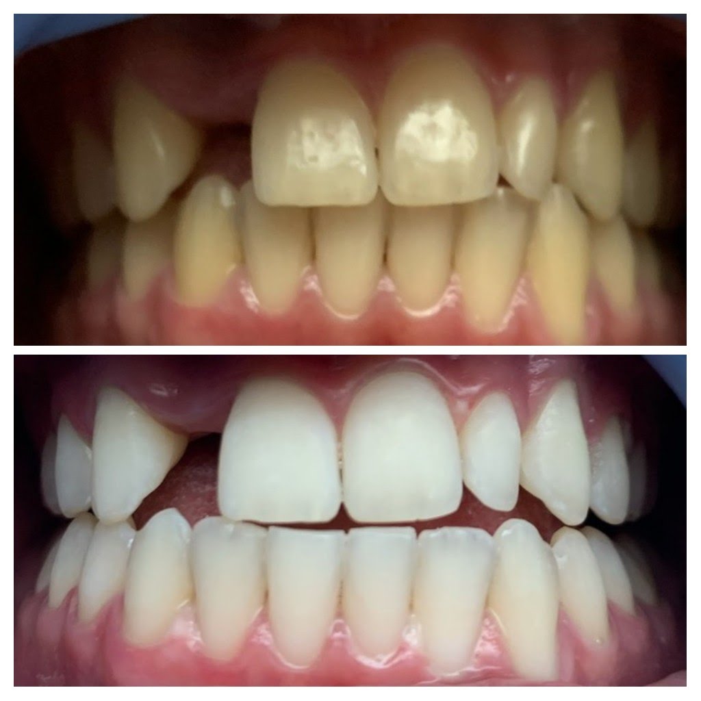Before & After