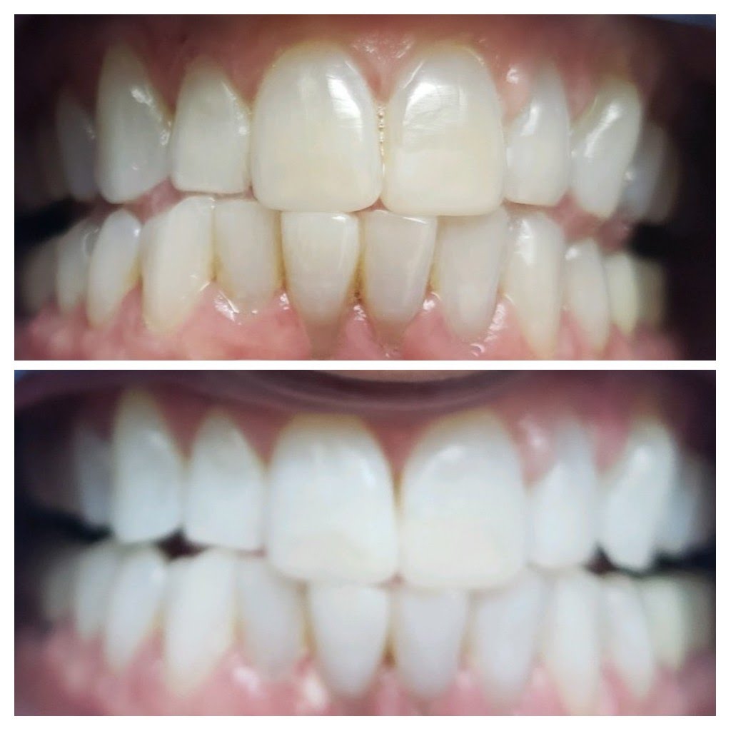 Before & After