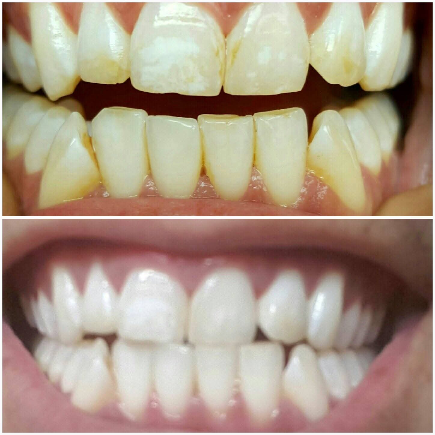 Before & After