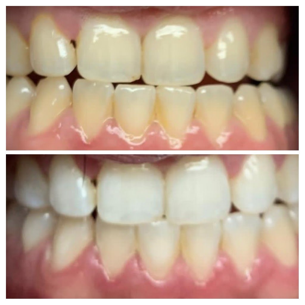 Before & After
