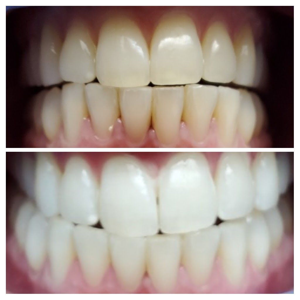 Before & After