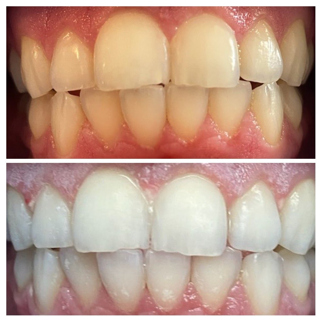 Before & After