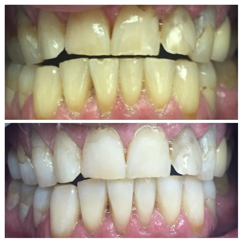 Before & After