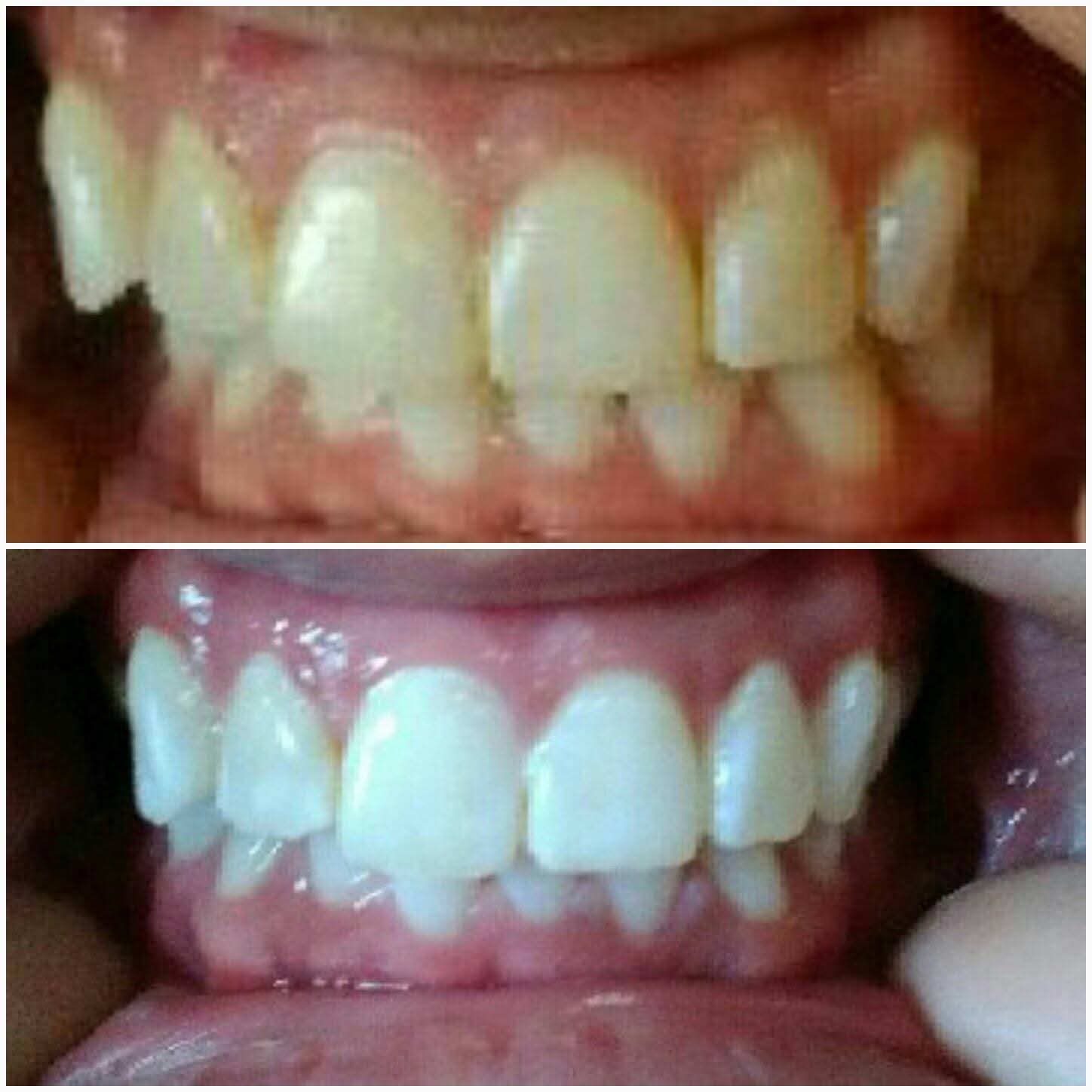 Before & After