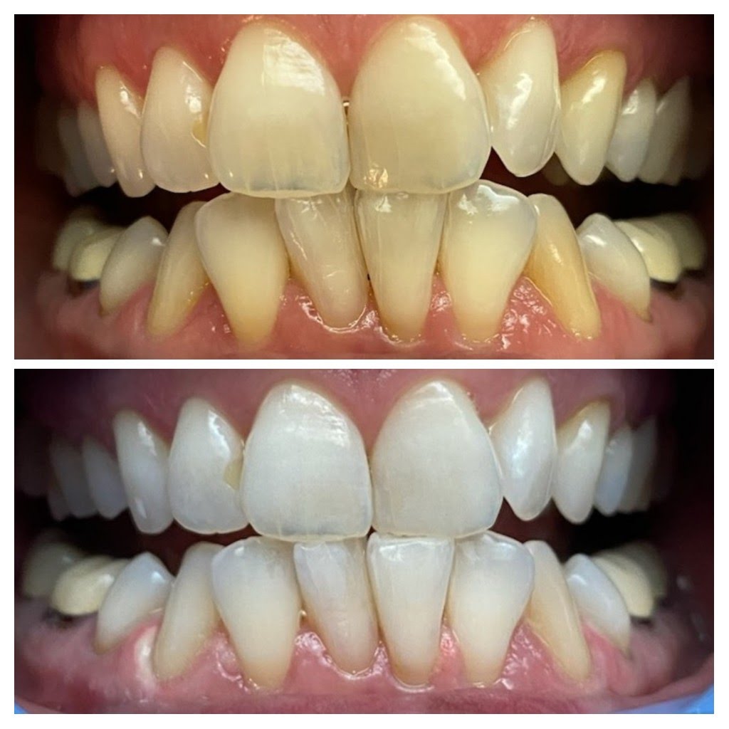 Before & After