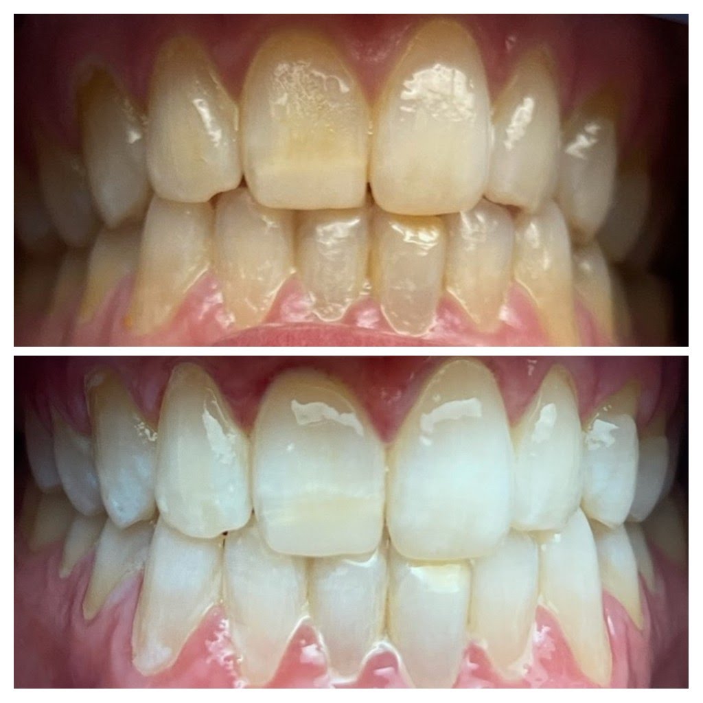 Before & After