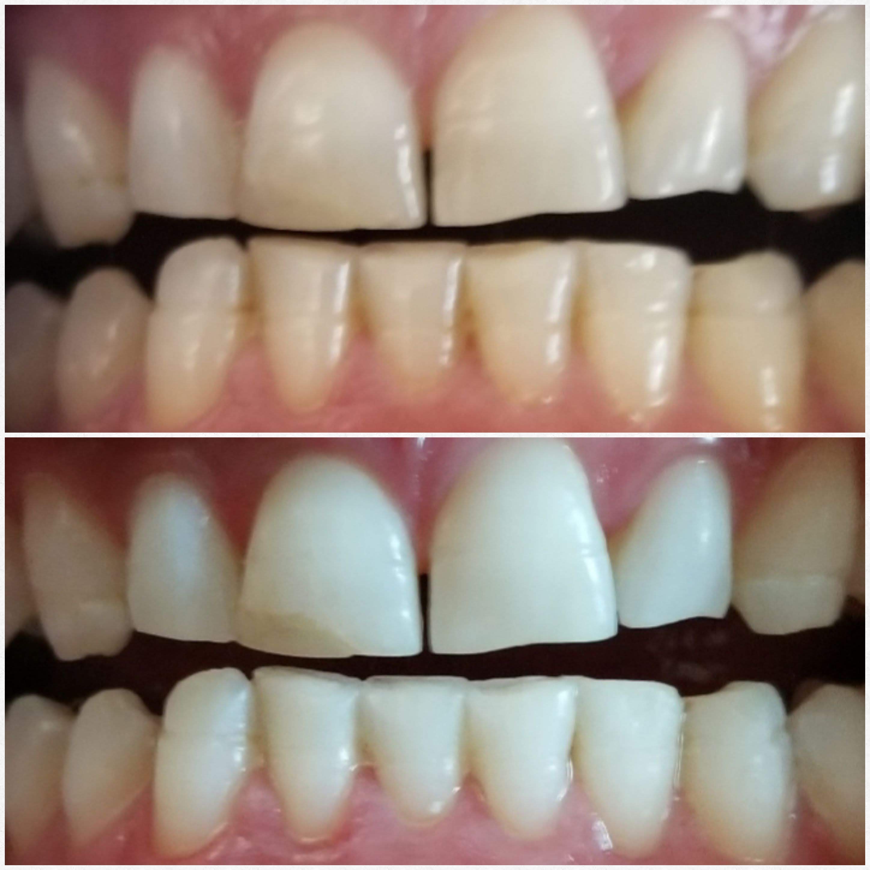 Before & After