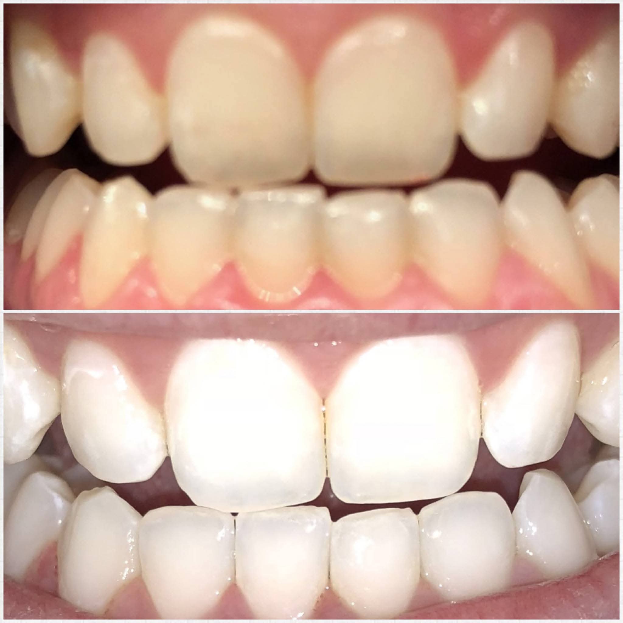 Before & After