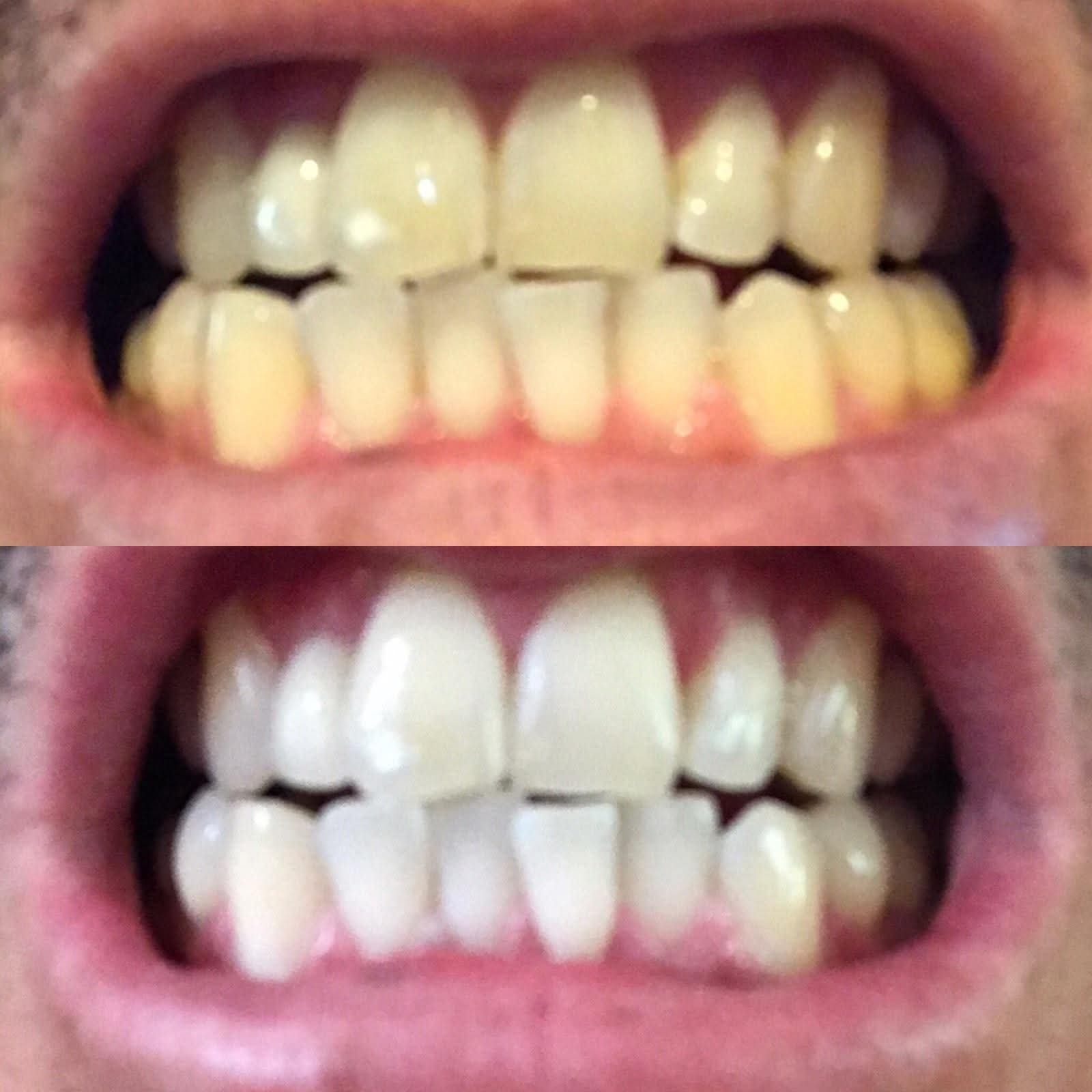 Before & After