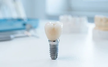 Dental Implants
