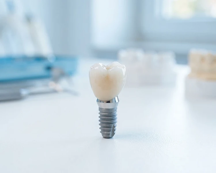 Dental Implants